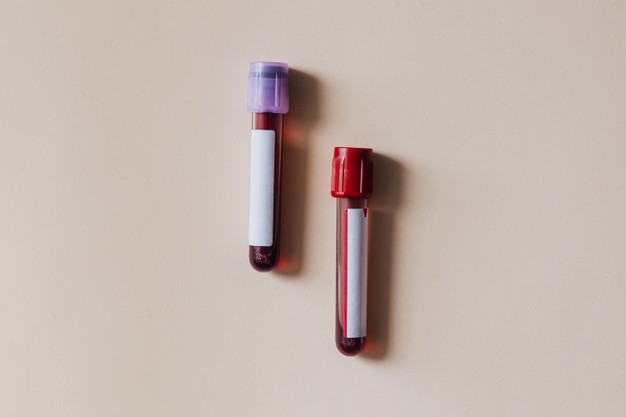 tubos de teste de sangue em uma superficie bege