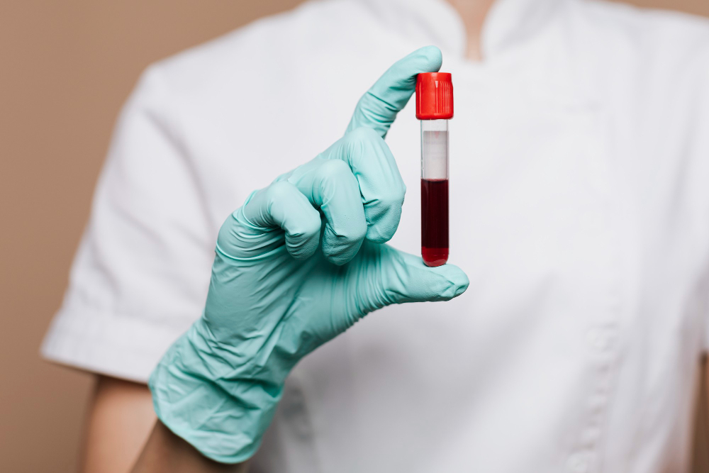 nurse holding a blood test tube