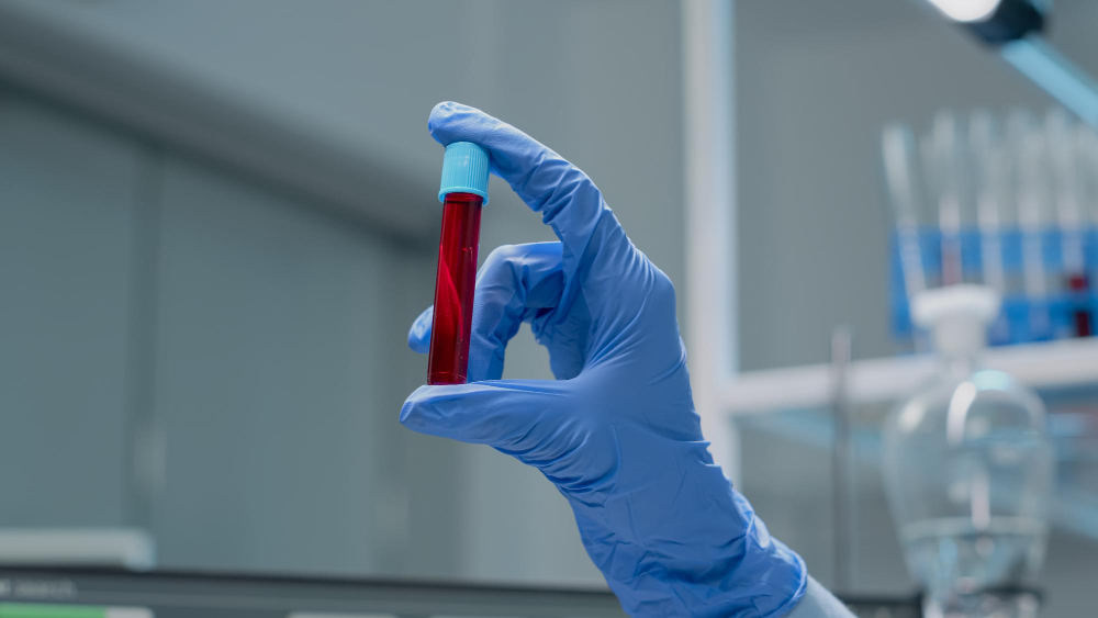 close up of specialist hand with gloves holding vacutainer with red solution or blood in research laboratory glass science instrument with liquid in transparent beaker used for innovation