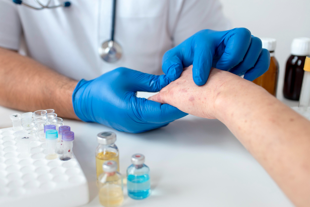 skin allergy on a person s arm