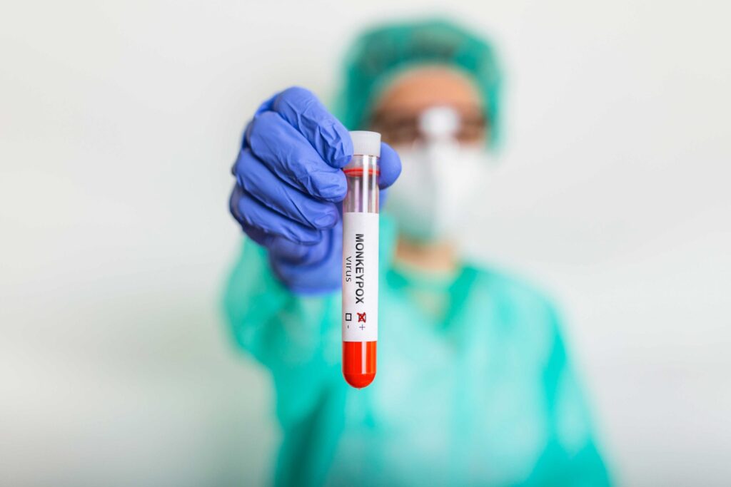 monkeypox virus test it is also known as the moneypox virus is a doublestranded dna zoonotic virus and a species of the genus orthopoxvirus in the family poxviridae